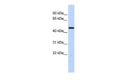 5-HT3C Rabbit anti-Human, Polyclonal, Novus Biologicals:Antibodies:Primary
